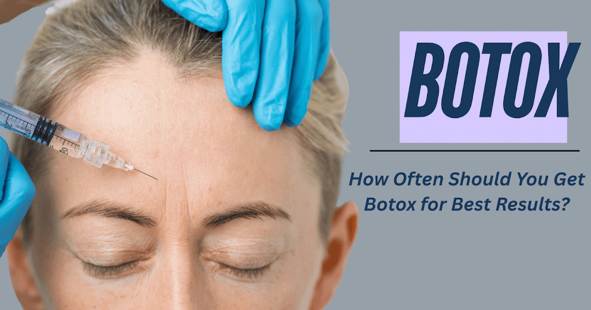 How Usually Ought to You Get Botox for Finest Outcomes?