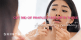 5 In a single day DIY Pimples Spot Remedies and Merchandise
