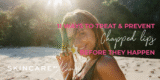 Chapped Lips Therapies | Prevention and House Treatments