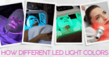 How Totally different LED Gentle Colours Help Collagen, Zits Therapeutic & Anti-Growing older