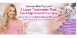 Uneven Pores and skin Texture? 5 Laser Therapies That Can Assist Clean Your Pores and skin